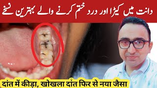 Top 4 Home Remedies For Tooth Cavity  Dental Carries  Dr Javaid [upl. by Airekat]