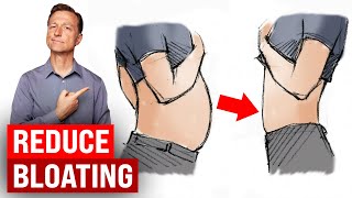 How to Stop BLOATING Fast  Learn the 5 Causes  Dr Berg [upl. by Ykvir874]