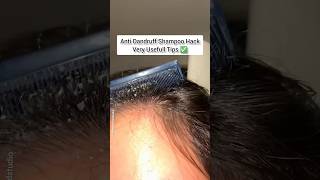 🔥Most Powerfull Anti Dandruff Shampoo Hack ❤️  Hair Growth Tips ✅ shorts youtubeshorts [upl. by Grimonia]