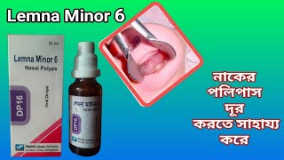 Lemna Minor 6 \\Nasal Polyps\\Oral Drops\\ নাকের পলিপাস চিকিৎসা ঔষধ সেবন করুন Bangla Review [upl. by Manno855]