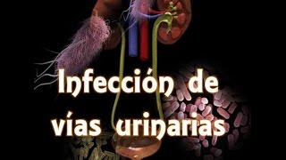 Infección de vías urinarias IVU [upl. by Attenaz]