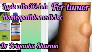 lapis Alba homeopathic medicine for Lipoma and tumorlapis Alba 30 uses in hindi [upl. by Hayikaz]