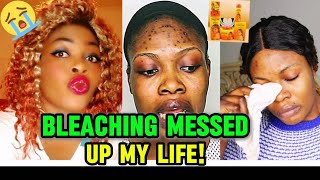 MUST SEEAn African American Woman Cries For Her Life After Bleaching Her Skin Fails [upl. by Stuppy]