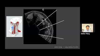 Halslymphknoten im Ultraschall [upl. by Adnyc]