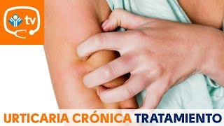 🔴 URTICARIA  Que es Sintomas y tratamiento drapilarochoa  Dermatologa [upl. by Siramaj874]