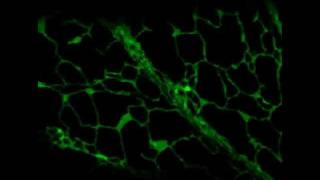 GFP  Endoplasmic reticulum in a plant cell [upl. by Bobker]