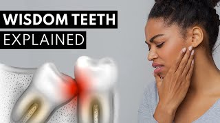 Wisdom Teeth Explained Pain Symptoms amp Extractions [upl. by Marjory]