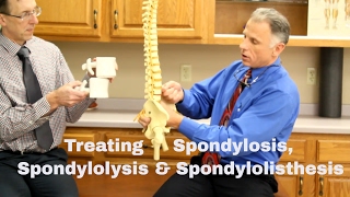 Treating Spondylosis Spondylolysis amp Spondylolisthesis Lumbar Spine [upl. by Rivalee388]