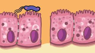 Pathogenesis of Opisthorchis viverrini and Helicobacter pylori coinfection [upl. by Hardie]