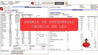 ANEMIA DE ENFERMEDAD CRÓNICA EN LUPUS ERITEMATOSO SISTEMICO [upl. by Clo986]