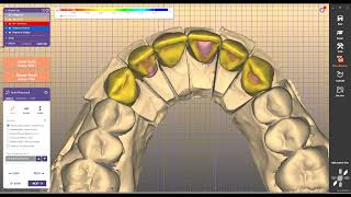 dentalsoftware installdentalsoftware exocad exoplan 3shape inlab cerec [upl. by Ainos]