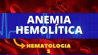 ANEMIA HEMOLÍTICA  HEMATOLOGIA  AULA 5 [upl. by Onig564]