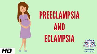 Preeclampsia and Eclampsia Causes Signs and Symptoms Diagnosis and Treatment [upl. by Pinebrook]