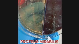 All About Proteus mirabilis  Everything You Need to Know About Proteus mirabilis [upl. by Artemla]