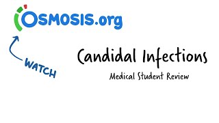 Candidal Infections Osmosis Study Video [upl. by Guido]