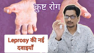 Leprosy की नई दवाइयाँ  कुष्ट रोग  New Medicine for Hansens Disease leprosy hansen Treatment [upl. by Bricker489]