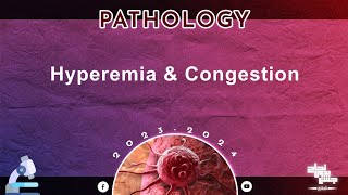 L13 Hyperemia and congestion Pathology [upl. by Lytsirk]