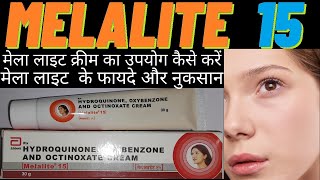 melalite cream use in hindi मेला लाइट क्रीम का उपयोग कैसे करें how to use melalite 15 side amp effects [upl. by Mara579]