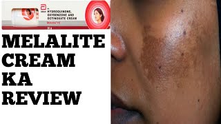 Melalite Cream Review in Hindi [upl. by Briggs765]