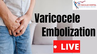 Varicocele  Varicocele Embolization Live Video in India By Varicocele Expert [upl. by Weihs]