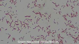 Gram Negative Rods under the Microscope at various magnification [upl. by Amaso102]