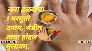 हिवाळ्यात करा हळदीचा 1 घरगुती उपाय थंडीत त्वचा होइल मुलायमNatural Remedy For Dry Skin In Winter [upl. by Anovad523]