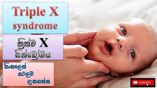 Triple X syndrome ත්‍රිත්ව X සින්ඩ්‍රෝමය how it happens causes symptoms treatments how prevent [upl. by Jeffy]