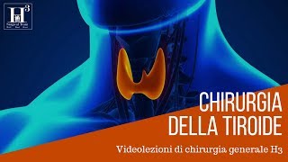 Chirurgia della tiroide [upl. by Atnamas135]