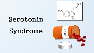 Serotonin Syndrome [upl. by Sternberg104]