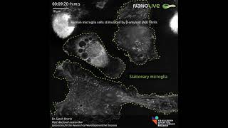 Human microglia cells stimulated by amyloidbeta Aβ fibrils [upl. by Liggett]