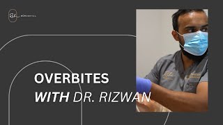 Why You Should Fix An Overbite With Dr Rizwan [upl. by Dong]