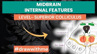 Midbrain Cross Sectional Anatomy  Internal features  level of Superior Colliculus [upl. by Atiuqa]