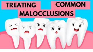 Management of Common Malocclusions Orthodontics [upl. by Marquardt389]