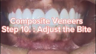 Composite Veneers Step 10 Adjust the Bite [upl. by Itsyrc]