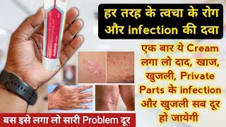 best medicine for fungal infection  itchaway skin cream  dad khaj khujli ki best cream  खुजली की [upl. by Ahsinauj]