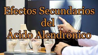 Efectos Secundarios del Ácido Alendrónico [upl. by Saltzman]