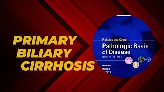 Primary biliary cirrhosis  Pathogenesis  Morphology  Clinical features [upl. by Dore522]