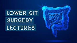 GIT SURGERY lecture 48 MECKELS DIVERTICULUM important points made easy [upl. by Shelia871]