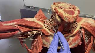 Upper Limb Brachial Plexus and Posterior Compartment Muscles in Plastinated Cadaver [upl. by Pascoe]