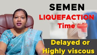 Semen liquefaction time in tamil DrPIswarya Devi MD Siddha [upl. by Sorodoeht126]