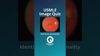 ⬆️More high yield USMLE here  📌Answer in comments usmle usmlestep1 medstudent medschool shorts [upl. by Blau]