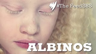 Albinos In Brazil [upl. by Shaeffer]