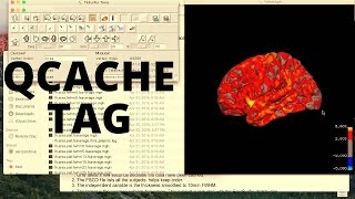 FreeSurfer Qcache Command [upl. by Nauqet]
