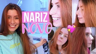 VLOG MINHA RINOPLASTIA CIRURGIA NO NARIZ [upl. by Alexandr136]