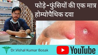 Boilsफोड़ेफुंसियां top Homeopathic medicine and management BosakHomeopathy फोड़ा घाव [upl. by Gottuard529]