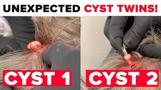 UNEXPECTED CYST TWINS [upl. by Ahsiyn]