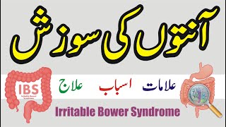 Anton ki sozish ka ilaj  Ibs irritable bowel syndrome  Anton ki sujan or zakhm ka ilaj in urdu [upl. by Eisned]