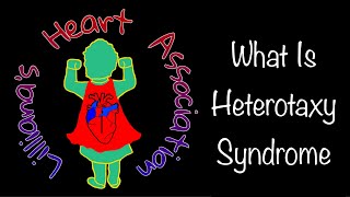 What is Heterotaxy Syndrome  Lilliana’s Heart Association [upl. by Whetstone]