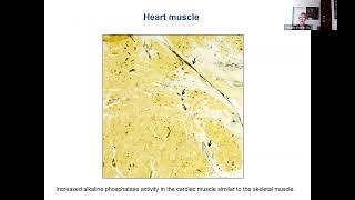 Myositis and Heart Disease with Dr Christina CharlesSchoeman [upl. by Seessel319]