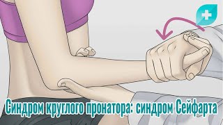 Синдром круглого пронатора синдром Сейфарта [upl. by Nalor]